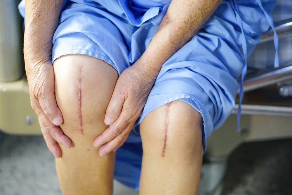 Post-operative massage after knee replacement